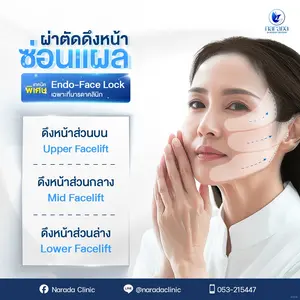ดึงหน้าย้อนวัยด้วยเทคนิค Endo-Face Lock ยกกระชับใบหน้าเฉพาะทางจากนารดาคลินิก