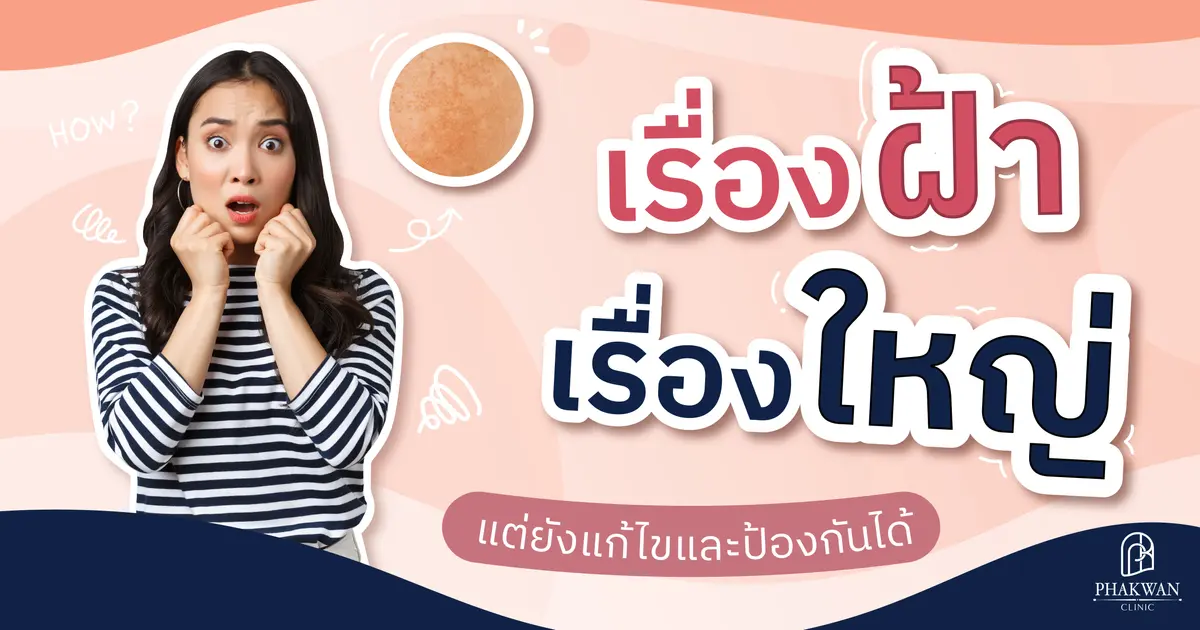 ปัญหาฝ้าสุดหนักใจ รักษายังไงได้บ้าง?