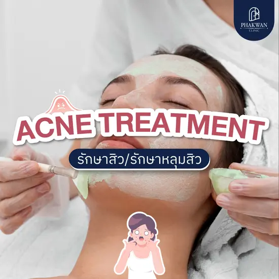 Acne Treatment รักษาสิว/รักษาหลุมสิว