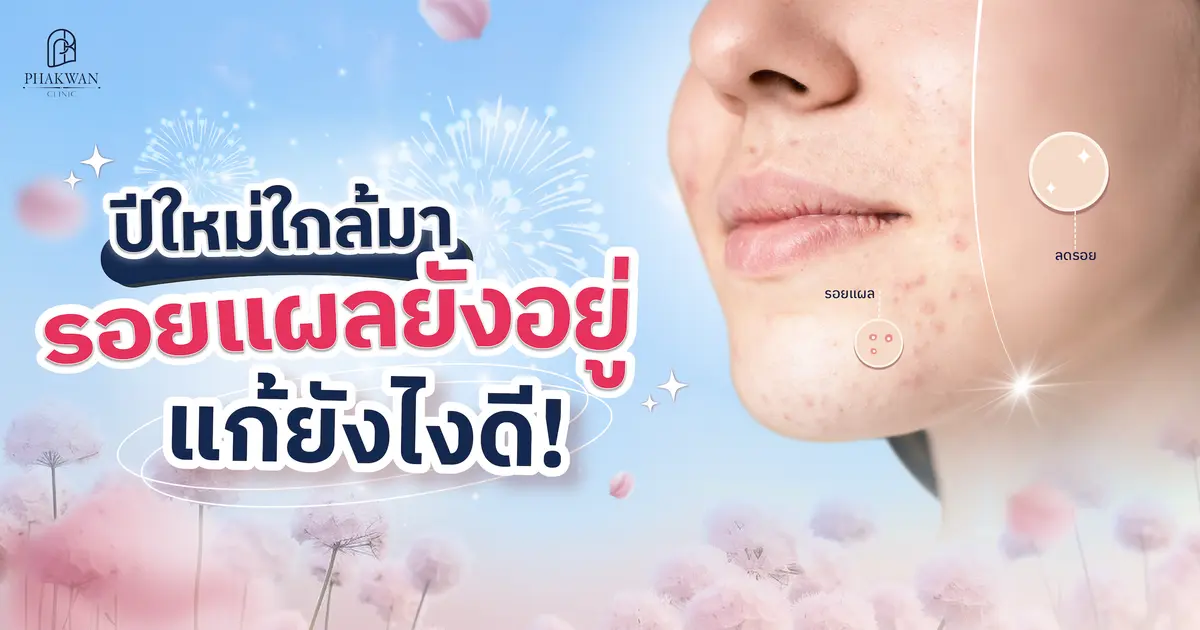 รอยแผลเป็นทำให้ไม่มั่นใจ? อยากผิวเนียนทันปีใหม่ ต้อง Pico Second Laser