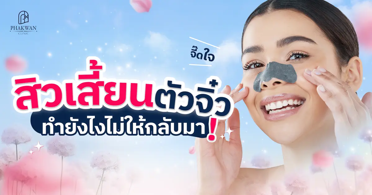 สิวเสี้ยนตัวจิ๋ว แต่จี๊ดใจ ทำยังไงไม่ให้กลับมา!?