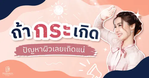 ปัญหาเรื่องกระ ไม่เคยกระจิ๋วหลิว