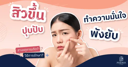 ชนิดของสิวมีอะไรบ้าง?
