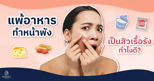 แพ้อาหารทำหน้าพัง กลายเป็นสิวเรื้อรังทำไงดี? | พาขวัญคลินิกหาดใหญ่