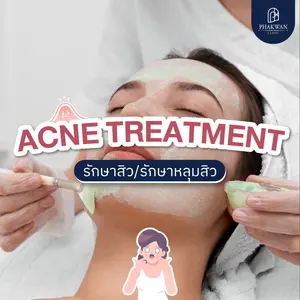 Acne Treatment รักษาสิว/รักษาหลุมสิว
