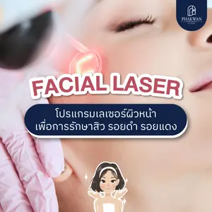 Facial Laser โปรแกรมเลเซอร์ผิวหน้าเพื่อการรักษาสิว 