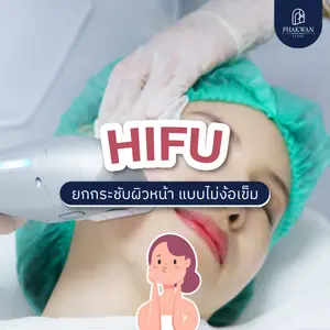HIFU ยกกระชับผิวหน้า แบบไม่ง้อเข็ม ไม่ต้องผ่าตัด