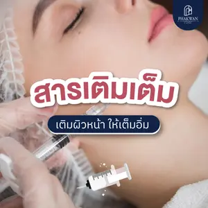 สารเติมเต็ม เติมผิวหน้าให้อิ่มฟู