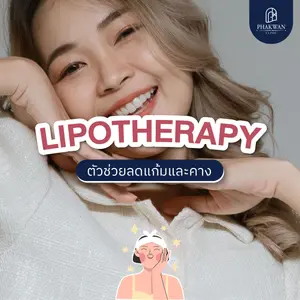 Lipotherapy ลดไขมันแก้มและคาง