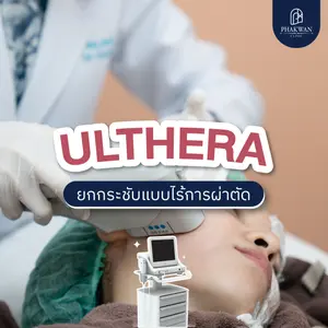 Ulthera เทคโนโลยียกกระชับแบบไม่พึ่งการผ่าตัด