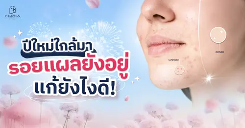 รอยแผลเป็นทำให้ไม่มั่นใจ? อยากผิวเนียนทันปีใหม่ ต้อง Pico Second Laser