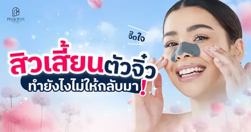 สิวเสี้ยนตัวจิ๋ว แต่จี๊ดใจ ทำยังไงไม่ให้กลับมา!?