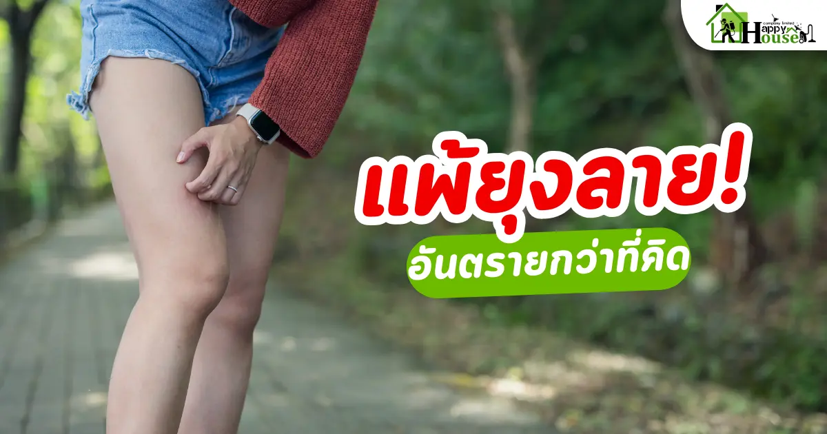 แพ้ยุงลายอันตรายกว่าที่คิด! แพ้ยุงลายอันตรายกว่าที่คิด!