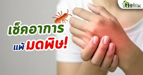 เช็คอาการ แพ้มดพิษ