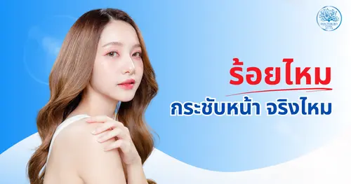 ร้อยไหม ฟื้นตัวเร็วจริงไหม? ร้อยไหมกระชับหน้า อยากหน้าเรียวต้องลอง