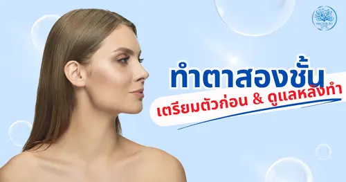 การเตรียมตัวก่อนและการดูแลหลังทำตาสองชั้น – เพื่อผลลัพธ์ที่ดีที่สุด