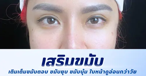 เสริมขมับปลอดภัยไหม สรุปข้อควรรู้ก่อนเลือกทำ