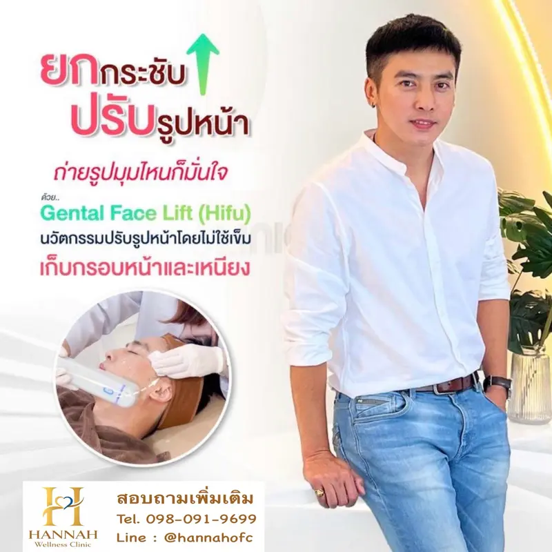 HIFU ยกกระชับปรับรูปหน้า