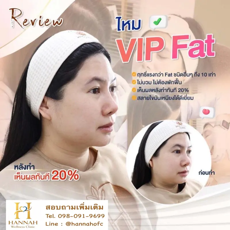 สลายไขมัน