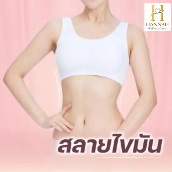ฉีดสลายไขมันส่วนเกิน