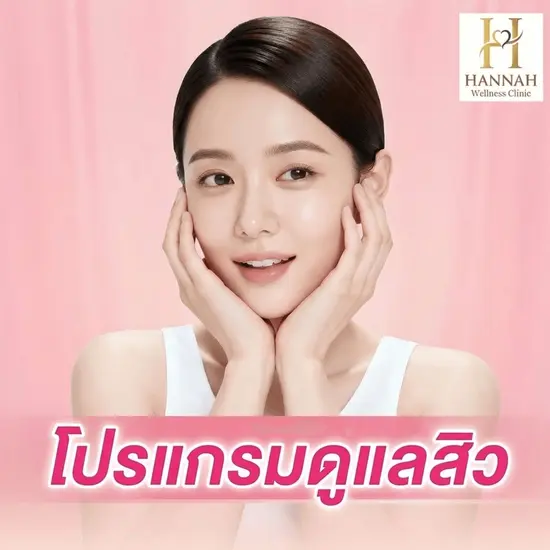 โปรแกรมดูแลสิวเรื้อรังและสมดุลผิวจากภายใน (Acne Wellness & Internal Balance Program)