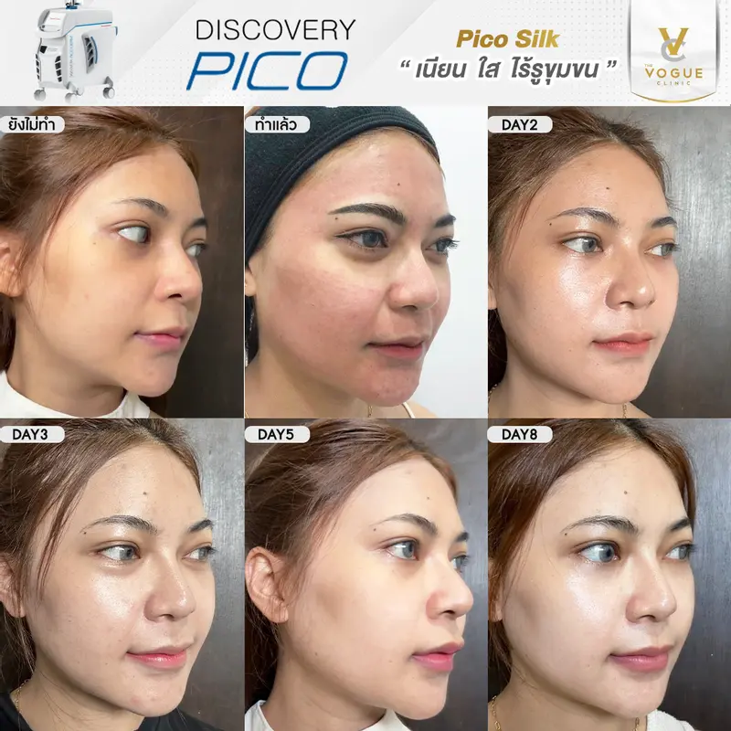 Discovery Pico ชลบุรี