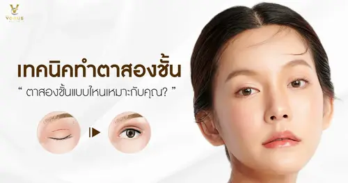 ตาสองชั้นแบบไหนเหมาะกับคุณ?