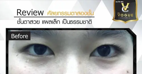 เปลี่ยนอาหมวย เป็นสาวหวาน ตาโต