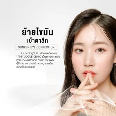 ย้ายไขมันแก้ไขเบ้าตาลึก