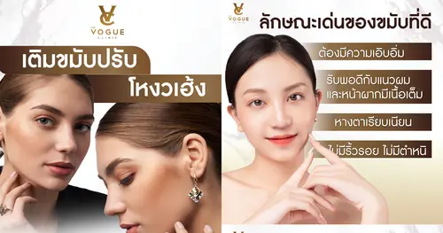 ฟิลเลอร์หน้าผากพลิกชะตาฟ้า เสริมโหงวเฮ้ง วาสนาดีไม่หยุด ฉุดไม่อยู่