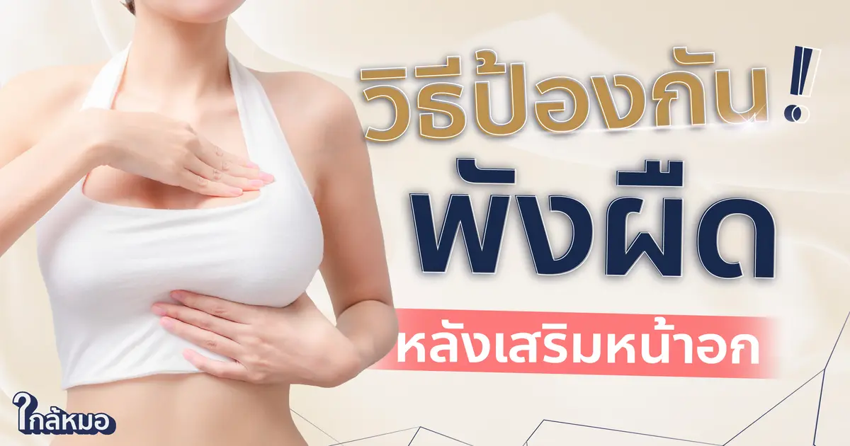 ไม่อยากเป็นพังผืดหลังเสริมหน้าอก ป้องกันอย่างไรดี ?