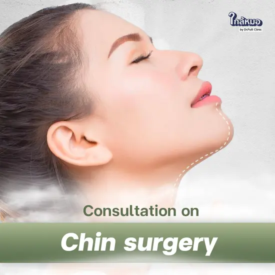 Chin Augmentation Consultation