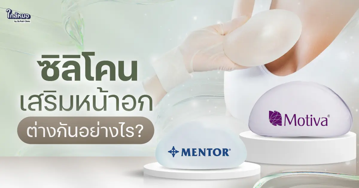  ซิลิโคนเสริมหน้าอก Motiva กับ Mentor ต่างกันอย่างไร ?