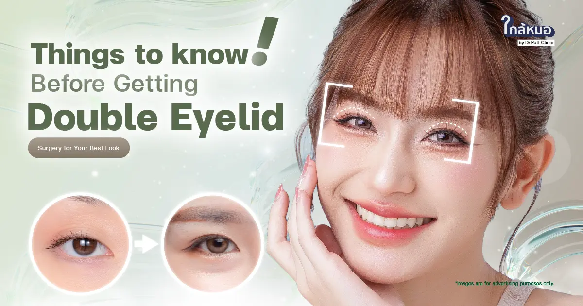 Things to Know Before Getting Double Eyelid Surgery for Your Best Look !