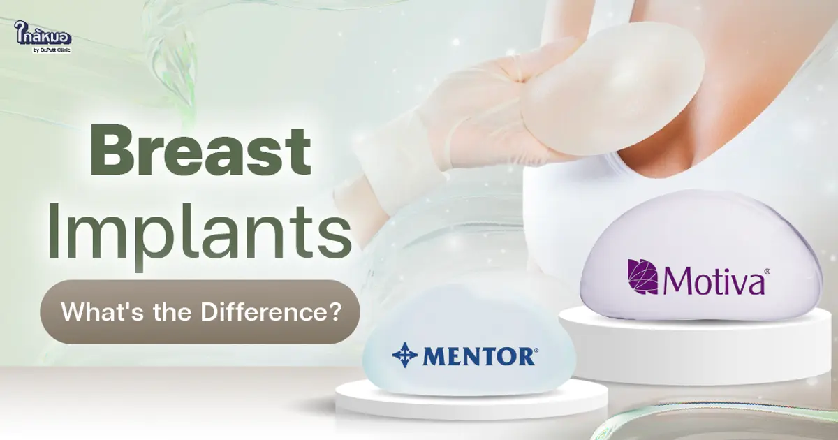 Motiva vs. Mentor Breast Implants: What's the Difference ?
