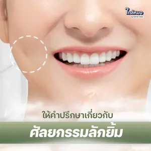 ให้คำปรึกษาเกี่ยวกับศัลยกรรมลักยิ้ม