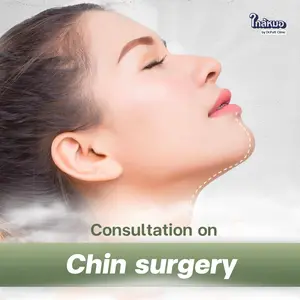 Chin Augmentation Consultation