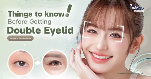 Things to Know Before Getting Double Eyelid Surgery for Your Best Look !