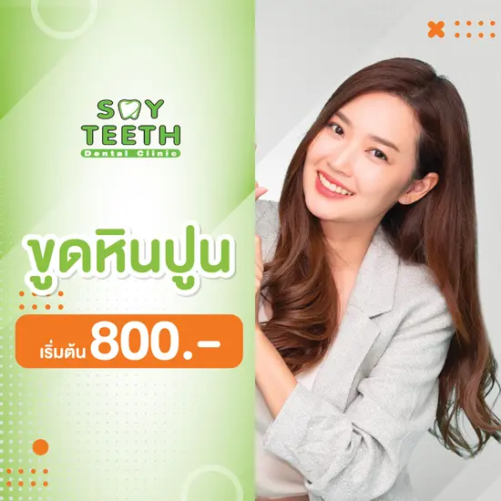 ขูดหินปูน ราคาเริ่มต้น 800 บาท ขูดหินปูน ขัดฟันขาวเพื่อลดกลิ่นปาก