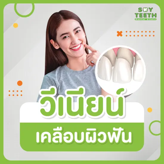 วีเนียร์ เคลือบผิวฟัน ฟันขาวกระจ่างใส แปะฟันขาวสไตล์ดารา